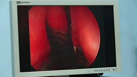 Medical  research 2 Stock Footage 317081386