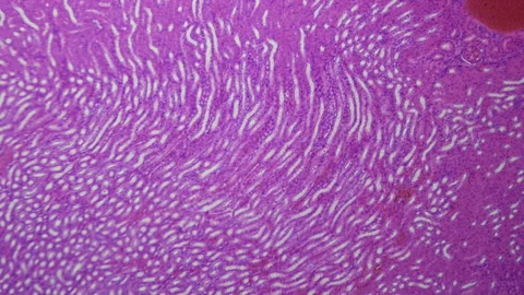 Medical research. Kidney under the microscope. 100x  times magnification Stock Footage 265180895