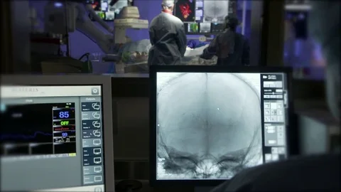 Medical Scan CAT Stock Footage 79930465