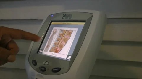 Medical scan spinal Stock Footage 35108176