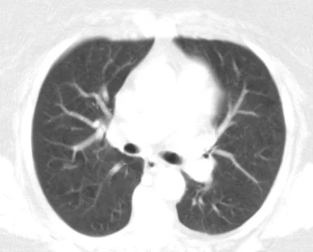 Medical Scan X-ray Loop PAL Stock Footage 1044202