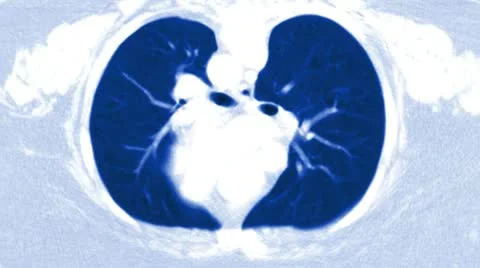 Medical Scan X-ray Loop Full HD Stock Footage 10732503