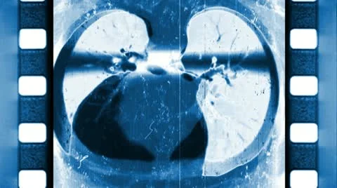 Medical Scan X-ray Loop Stock Footage 10868466