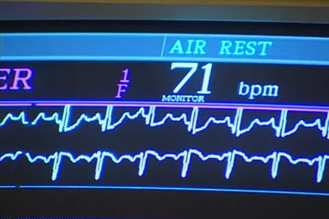 Medical Screen 1 Stock Footage 22396898