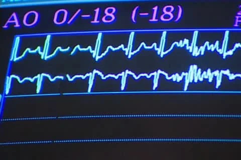 Medical Screen 2 Stock Footage 22396949