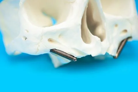 Medical skull pattern with false teeth pins on blue background Stockfoto's