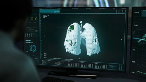 Medical Specialist Works On Computer With Software To Detect Covid-19 Presence Video stock 154468147