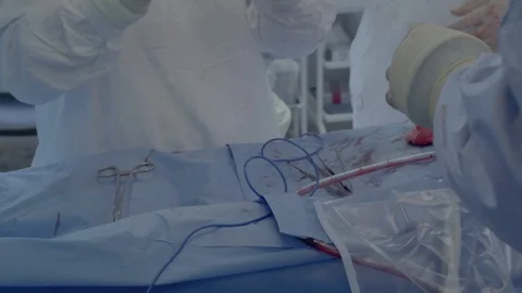 Medical staff of the operating unit do heart surgery Stock Footage 104921803