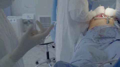 Medical staff of the operating unit do heart surgery. The nurse assists in Stock Footage 104922353