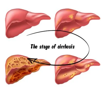 Medical structure of the liver Stock Illustration