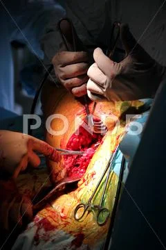 Medical surgery 2 Stock Photos