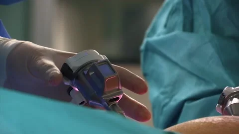 MEDICAL SURGICAL USING DEVICES DURING THE OPERATION Stock Footage 201741624