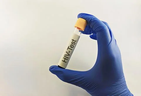 Medical technician preparing a human sample for HIV testing. Stock Photos
