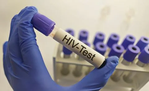Medical technician preparing a human sample for HIV testing. Stock Photos