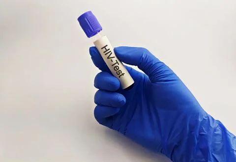 Medical technician preparing a human sample for HIV testing. Stock Photos
