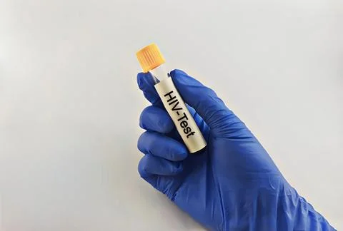 Medical technician preparing a human sample for HIV testing. Stock Photos