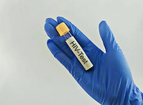 Medical technician preparing a human sample for HIV testing. Foto stock