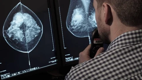 Medical Technician Reviewing X ray Scans Over The Shoulder Stock Footage