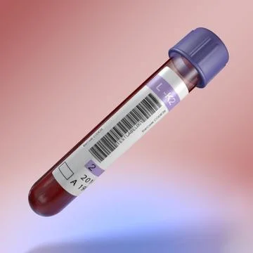 Medical test tube with blood 3D Model