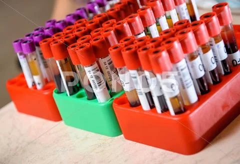 Medical test-tube with blood samples Stock Photos