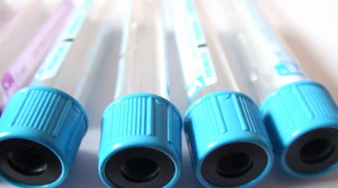 Medical Test - Tubes 1 Stock Footage 37009488