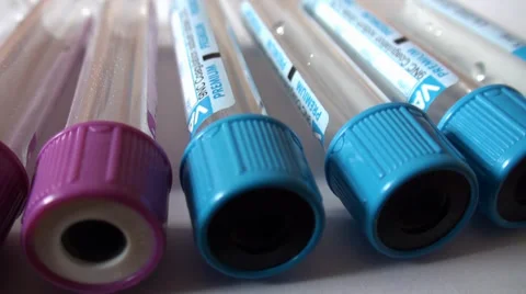 Medical Test - Tubes 2 Stock Footage 37009489