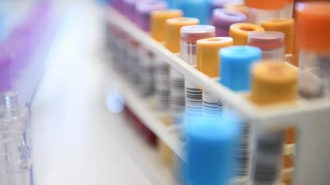 Medical testing of human samples in the laboratory Stock Footage 129901560