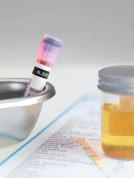 Medical testing Stock Photos