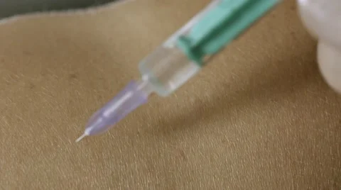 Medical Therapy Stock Footage 57396801