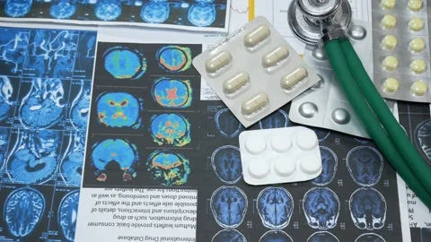 Medical tools with x-rays and pills Stock Footage 87426788