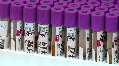 Medical tubes Stock Footage 68141085