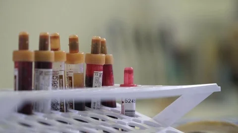 Medical tubes Stock Footage 70142108