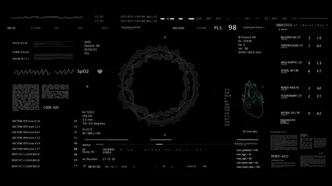 Medical UI HUD text data monitoring Video stock 290889111