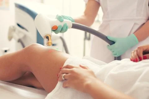 Medical worker using laser tool for removing stretches on the leg of client Stock Photos