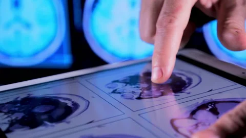 Medical x-ray  Stock Footage 163049134