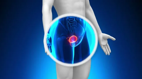 Medical X-Ray Scan - Bladder Stock Footage 32849276