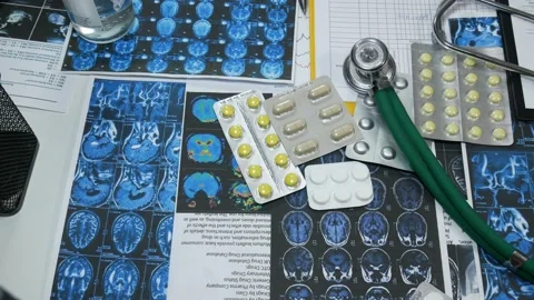 Medical X-rays of the brain and tablets on the table 動画素材 88440216