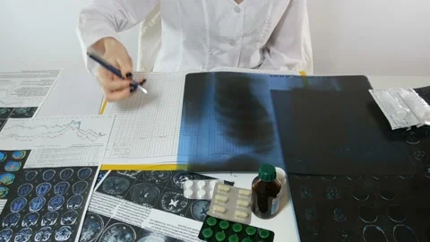 Medical X-rays Stock-Footage 87479619