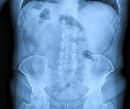Medical X-rays Stock Photos