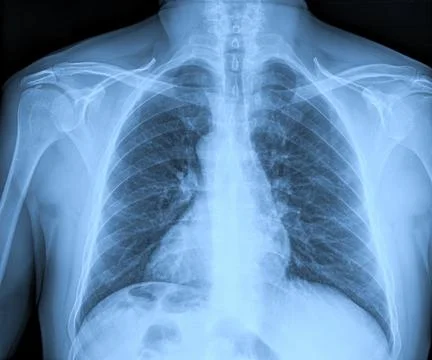 Medical X-rays Foto stock