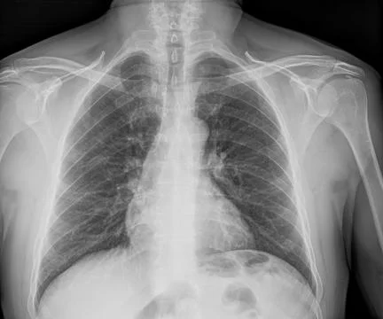 Medical X-rays Stock Photos