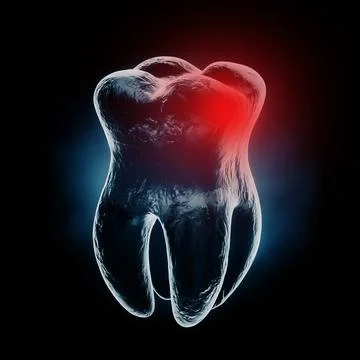 Medically Accurate Aching Tooth X-Ray View with Red Zone of Pain. 3d Renderin Stock Illustration