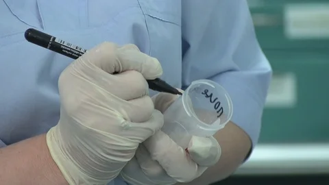 Medicine. The nurse makes a note on the plastic container for analysis. close-up Video stock 87007704