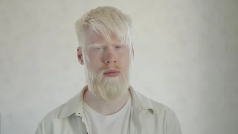 Medium close up of young albino man with white beard, hair. Vision problems Stock Footage 244849442