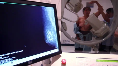 MEDIUM SHOT-HANDHELD SHOT. Nurse helping a woman during a mastography scan. Stock Footage 48199333