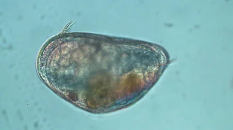 Meiobenthos Ostracod Stock Footage 68389876