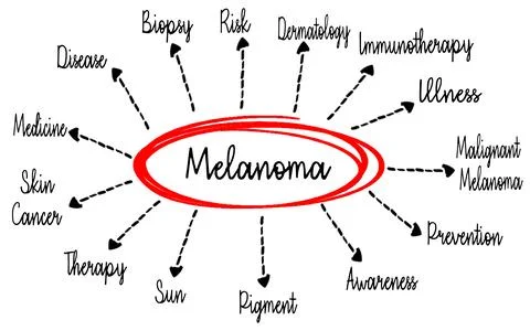 Melanoma Concept Map Highlighting Risks, Treatments, and Preventive Measures Stock Illustration