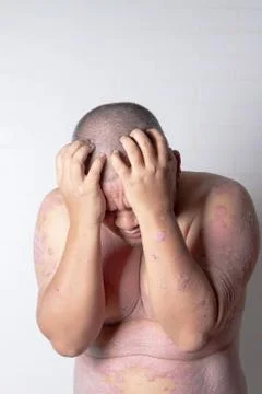 Men are using both hands to hold his head Stock Photos