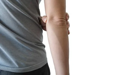 Men use their hands to hold their elbows and He had pain at the elbows.. Pain Stock Photos