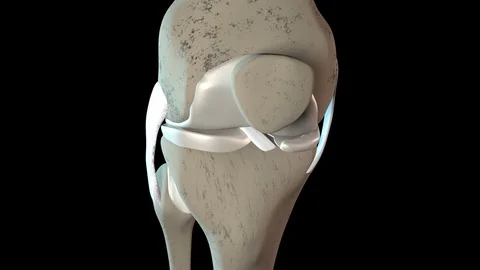 Meniscus Tear 스톡 동영상 122448147